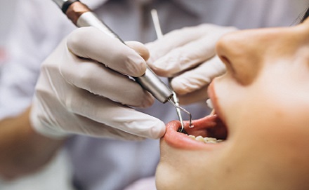Tratamiento dental Odontología General