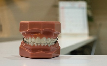 Tratamiento dental Ortodoncia