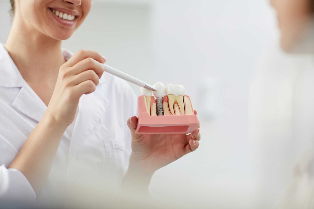 implantes dentales en Ugena y El Señorío de Illescas. Implantología Oral en Ugena y El Señorío de Illescas, implantes en Ugena y El señorío de Illescas.