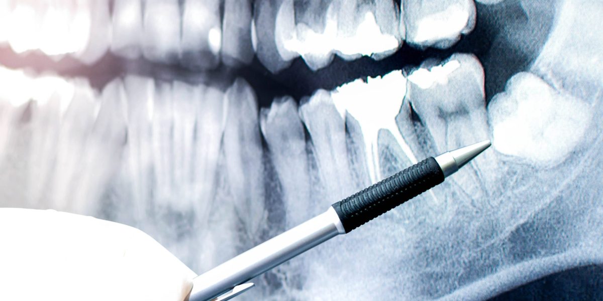 Cuida los tejidos profundos de tu boca con cirugía oral en Ugena y El Señorío de Illescas. Servicio quirúrgico seguro, personalizado y libre de dolor.