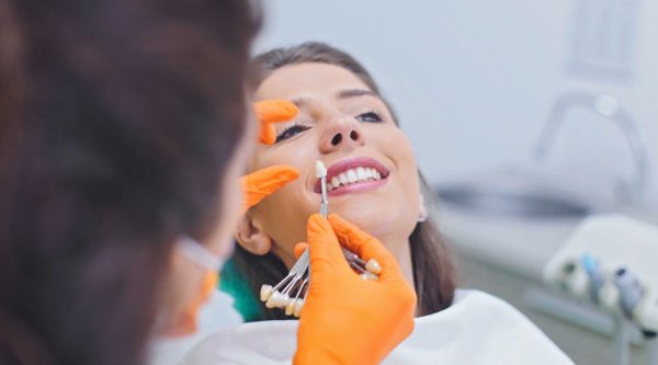 Estética dental en Ugena y El Señorío de Illescas. Blanqueamiento dental en Ugena y El Señorío de Illescas, carillas dentales en Ugena y El señorío, carillas de composite, carillas de cerámica, blanqueamiento en casa, blanqueamiento en clínica.