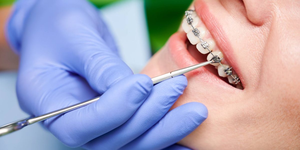 Ortodoncia en Ugena y El Señorío de Illescas. Ortodoncia de brackets metálicos en Ugena y El Señorío, ortodoncia de brackets estéticos en Ugena y El Señorío, ortodoncia invisible en El Señorío, ortodoncia infantil en Ugena y El Señorío, ortopedia en Ugena y El Señorío.
