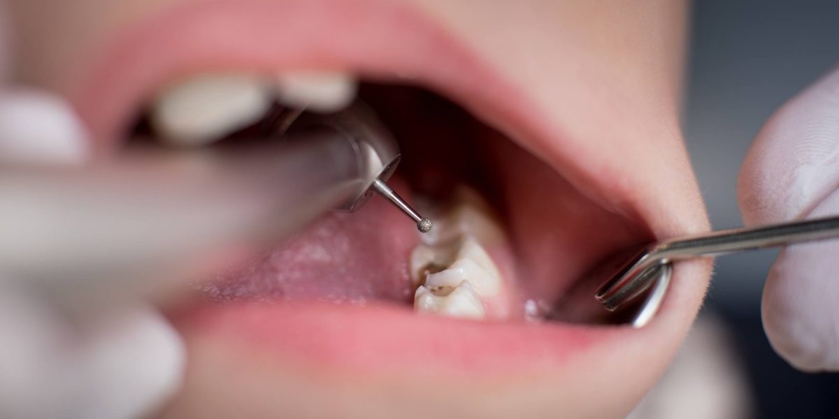Odontopediatría en Ugena y El Señorío de Illescas. dentista para niños en Ugena y El Señorío de Illescas, odontología para niños en Ugena y El Señorío de Illescas, clínica dental para niños en Ugena y El Señorío.