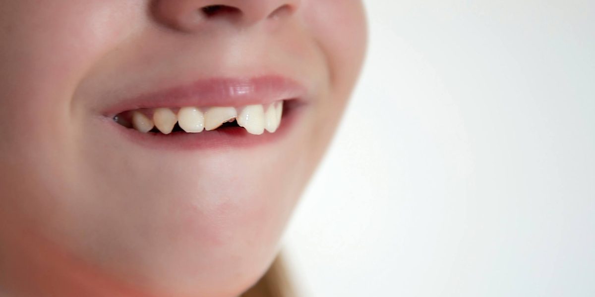 Odontopediatría en Ugena y El Señorío de Illescas. dentista para niños en Ugena y El Señorío de Illescas, odontología para niños en Ugena y El Señorío de Illescas, clínica dental para niños en Ugena y El Señorío.